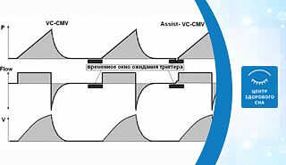 Искусственная вентиляция легких с контролем по объему - Volume Control Ventilation (CMV, VC-CMV, IPPV, VCV)